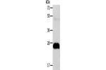 Gel: 12%SDS-PAGE, Lysate: 40 