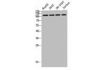 Western blot analysis of SW480 MCF7 lysate, antibody was diluted at 500. Secondary antibody  was diluted at 1:20000
