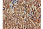 Immunohistochemistry of paraffin-embedded human liver tissue using CSB-PA10209A0Rb at dilution of 1:100