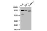 Western Blot<br />
Positive WB detected in:Raji whole cell lysate,THP-1 whole cell lysate,Raw264.7 whole cell lysate<br />
All lanes:ADAM8 antibody at 3.8