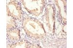 Immunohistochemistry of paraffin-embedded human prostate using CSB-PA10279A0Rb at dilution 1:100
