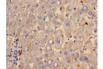 Immunohistochemistry of paraffin-embedded human liver tissue using CSB-PA10329A0Rb at dilution of 1:100