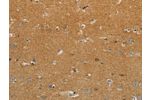The image on the left is immunohistochemistry of paraffin-embedded Human brain tissue using CSB-PA103567(GJB6 Antibody) at dilution 1/30, on the right is treated with synthetic peptide. (Original magnification: 