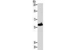 Gel: 8%SDS-PAGE, Lysate: 40 