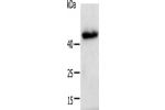 Gel: 12+15%SDS-PAGE, Lysate: 40 