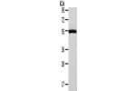 Gel: 8%SDS-PAGE, Lysate: 40 