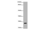 Western blot<br />
All lanes:CD3E antibody at 1.5ug/ml+Jurkat whole cell lysate<br />
Goat polyclonal to rabbit IgG at 1/10000 dilution<br />
Predicted band size: 23 kDa<br />
Observed band size: 23 kDa<br />