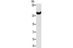 Gel: 6%SDS-PAGE, Lysate: 40 