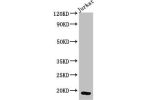 Western Blot<br />
Positive WB detected in:Jurkat whole cell lysate<br />
All lanes:CD247 antibody at 3