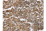 The image on the left is immunohistochemistry of paraffin-embedded Human tonsil tissue using CSB-PA105007(ECE1 Antibody) at dilution 1/60, on the right is treated with fusion protein. (Original magnification: 