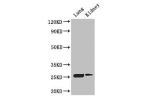 Western Blot<br />
Positive WB detected in:Mouse lung tissue,Mouse kidney tissue<br />
All lanes: CD9 antibody at 3ug/ml<br />
Secondary<br />
Goat polyclonal to rabbit IgG at 1/50000 dilution<br />
Predicted band size: 26 kDa<br />
Observed band size: 26
