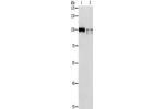 Gel: 8%SDS-PAGE, Lysate: 40 