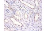 Immunohistochemistry of paraffin-embeded human prostate using CSB-PA10709A0Rb at dilution of 1:100