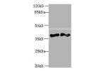 Western blot<br />
All lanes:DNAJB4 antibody at 2ug/ml<br />
Lane 1:Hela cells<br />
Lane 2:mouse heart tissue<br />
Secondary<br />
Goat polyclonal to rabbit at 1/10000 dilution<br />
Predicted band size: 38kDa<br />
Observed band size: 38kDa<br />