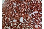 Immunohistochemical analysis of paraffin-embedded Human-kidney, antibody was diluted at 1:100