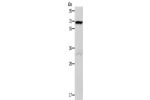 Gel: 10%SDS-PAGE, Lysate: 40 