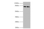 Western blot<br />
All lanes:Complement factor B antibody at 2ug/ml<br />
Lane 1:K562 whole cell lysate<br />
Lane 2:HepG2 whole cell lysate<br />
Secondary<br />
Goat polyclonal to rabbit at 1/10000 dilution<br />
Predicted band size: 86,69 kDa<br />
Obs