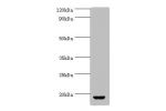 All lanes:Vasopressin-neurophysin 2-copeptin antibody at 2ug/ml+rat gonad tissue<br />
Secondary<br />
Goat polyclonal to rabbit at 1/10000 dilution<br />
Predicted band size: 17kDa<br />
Observed band size: 17kDa<br />