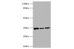 Western blot<br />
All lanes:AQP4 antibody at 2ug/ml<br />
Lane 1:mouse heart tissue<br />
Lane 2:mouse brain tissue<br />
Lane 3:mouse kidney tissue<br />
Secondary<br />
Goat polyclonal to rabbit at 1/10000 dilution<br />
Predicted band size: 35,33 kDa<