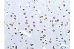 The image on the left is immunohistochemistry of paraffin-embedded Human brain tissue using CSB-PA111496(ACE2 Antibody) at dilution 1/30, on the right is treated with fusion protein. (Original magnification: 