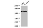 Western Blot<br />
Positive WB detected in:Mouse lung tissue,Mouse stomach tissue<br />
All lanes:GAD2 antibody at 2.7