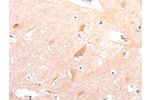 The image on the left is immunohistochemistry of paraffin-embedded Human brain tissue using CSB-PA112790(CELSR2 Antibody) at dilution 1/50, on the right is treated with synthetic peptide. (Original magnification: 