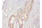 Immunohistochemistry of paraffin-embedded human prostate using CSB-PA11309A0Rb at dilution of 1:20