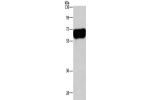 Gel: 8%SDS-PAGE,Lysate: 40 