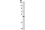 Gel: 10%SDS-PAGE, Lysate: 40 