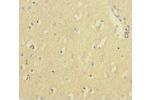 Immunohistochemistry of paraffin-embedded human brain tissue using CSB-PA11407A0Rb at dilution 1:100