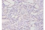Immunohistochemistry of paraffin-embedded human kidney using CSB-PA11409A0Rb at dilution of 1:20
