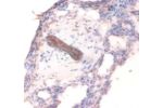 Immunohistochemistry of paraffin-embedded human lung using CSB-PA11464A0Rb at dilution of 1:100