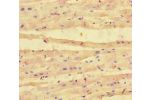 Immunohistochemistry of paraffin-embedded human heart tissue using CSB-PA11469A0Rb at dilution of 1:100