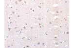 The image on the left is immunohistochemistry of paraffin-embedded Human brain tissue using CSB-PA114923(DTX1 Antibody) at dilution 1/20, on the right is treated with synthetic peptide. (Original magnification: 
