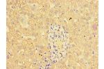 Immunohistochemistry of paraffin-embedded human liver tissue using CSB-PA11499A0Rb at dilution of 1:100