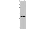Gel: 8%SDS-PAGE, Lysate: 40 