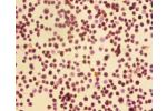 Immunohistochemistry of paraffin-embedded EC109 cells using CSB-PA11659A0Rb at dilution of 1:50