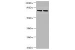 All lanes:Glutamate carboxypeptidase 2 antibody at 2ug/ml<br />
Lane 1:U251 whole cell lysate<br />
Lane 2:PC-3 whole cell lysate<br />
Secondary<br />
Goat polyclonal to rabbit at 1/10000 dilution<br />
Predicted band size: 85,13,10,79,83,81,51 kDa<br />