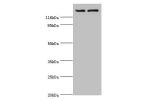 Western blot<br />
All lanes:Multidrug resistance protein 1 antibody at 2ug/ml<br />
Lane 1:HepG2 whole cell lysate<br />
Lane 2:EC109 whole cell lysate<br />
Secondary<br />
Goat polyclonal to rabbit at 1/10000 dilution<br />
Predicted band size: 142,135