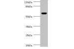 Western blot<br />
All lanes:Acetylcholine receptor subunit alpha antibody at 2ug/ml+rat skeletal muscleSecondary<br />
Goat polyclonal to Rabbit IgG at 1/10000 dilution<br />
Predicted band size: 55,52 kDa<br />
Observed band size: 55 kDa<br />