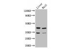 Western Blot<br />
Positive WB detected in:Mouse liver tissue,Raji whole cell lysate<br />
All lanes: BHMT2 antibody at 3ug/ml<br />
Secondary<br />
Goat polyclonal to rabbit IgG at 1/50000 dilution<br />
Predicted band size: 41,34 kDa<br />
Observed band