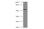 Western blot<br />
All lanes: Intestinal-type alkaline phosphatase antibody at 2ug/ml+293T whole cell lysate<br />
Secondary<br />
Goat polyclonal to Rabbit IgG at 1/10000 dilution<br />
Predicted band size: 58 kDa<br />
Observed band size: 58 kDa<br />