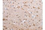 The image on the left is immunohistochemistry of paraffin-embedded Human brain tissue using CSB-PA120126(CFC1 Antibody) at dilution 1/20, on the right is treated with synthetic peptide. (Original magnification: 