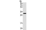 Gel: 12%SDS-PAGE, Lysate: 40 