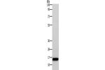 Gel: 12+15%SDS-PAGE, Lysate: 40 