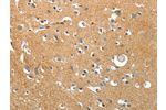 The image on the left is immunohistochemistry of paraffin-embedded Human brain tissue using CSB-PA123979(AKAP12 Antibody) at dilution 1/40, on the right is treated with synthetic peptide. (Original magnification: 