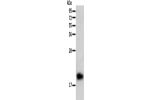 Gel: 12%SDS-PAGE, Lysate: 40 