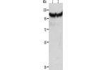 Gel: 10%SDS-PAGE, Lysate: 40 