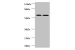 All lanes: Plasma alpha-L-fucosidase antibody at 2ug/ml<br />
Lane 1 : EC109 whole cell lysate<br />
Lane 2 : 293T whole cell lysate<br />
Secondary<br />
Goat polyclonal to rabbit IgG at 1/10000 dilution<br />
Predicted band size: 55,20 kDa<br />
Observe