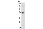 Gel: 8%SDS-PAGE, Lysate: 40 